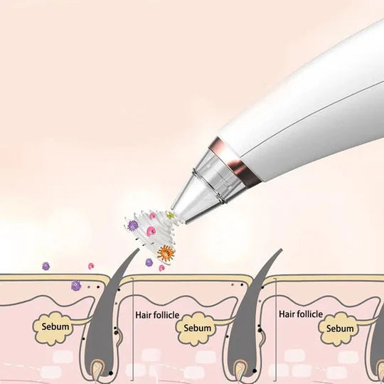 Vacuum Blackhead Remover Face Black Spots Cleaner White Dot Pimple Removal