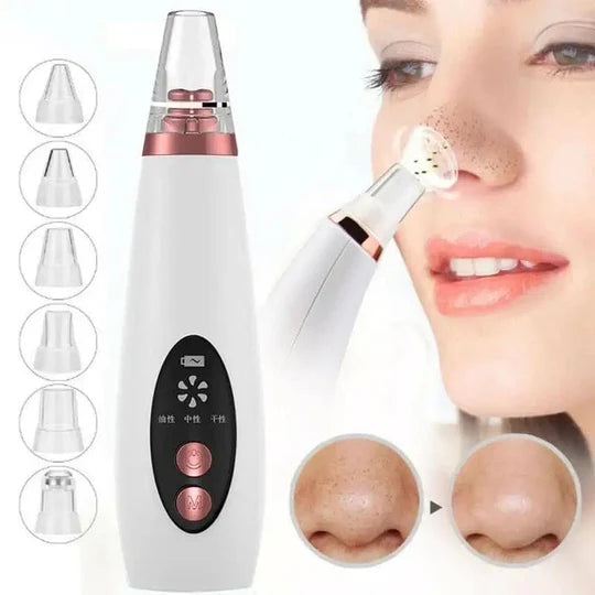 Vacuum Blackhead Remover Face Black Spots Cleaner White Dot Pimple Removal